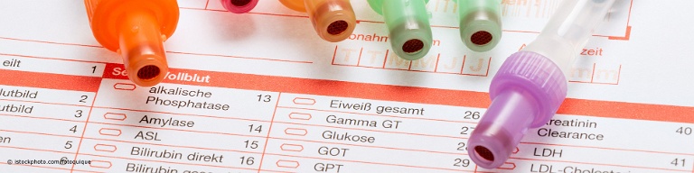 Tn ist als Laborwert die Abkürzung für Troponin.