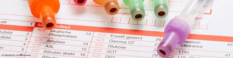 FSH ist die Abkürzung für Follikel-stimulierendes Hormon.