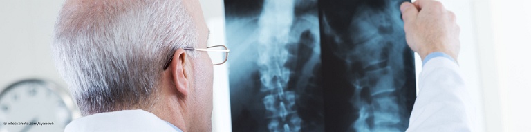 Bei DocInsider registrierter Radiologe betrachtet ein Röntgenbild der Halswirbelsäule