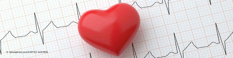 Herzrhythmusstörungen kann der Kardiologe mithilfe eines Kardiogramms erkennen.