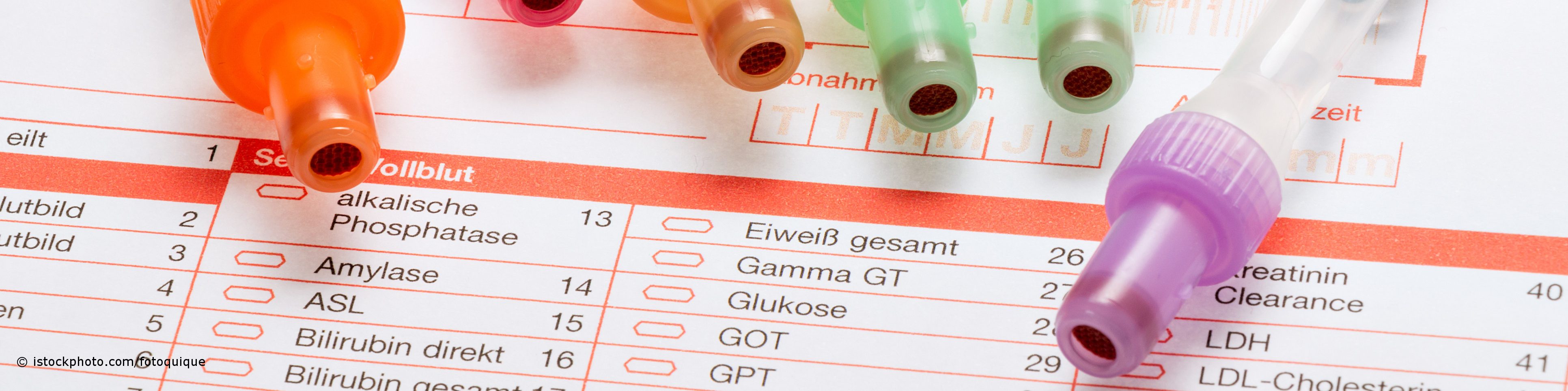 HbA1c ist als Laborwert die Abkürzung Hämoglobin-A1c. Er dient als Langzeitwert zur Kontrolle des Blutzuckerspiegels.