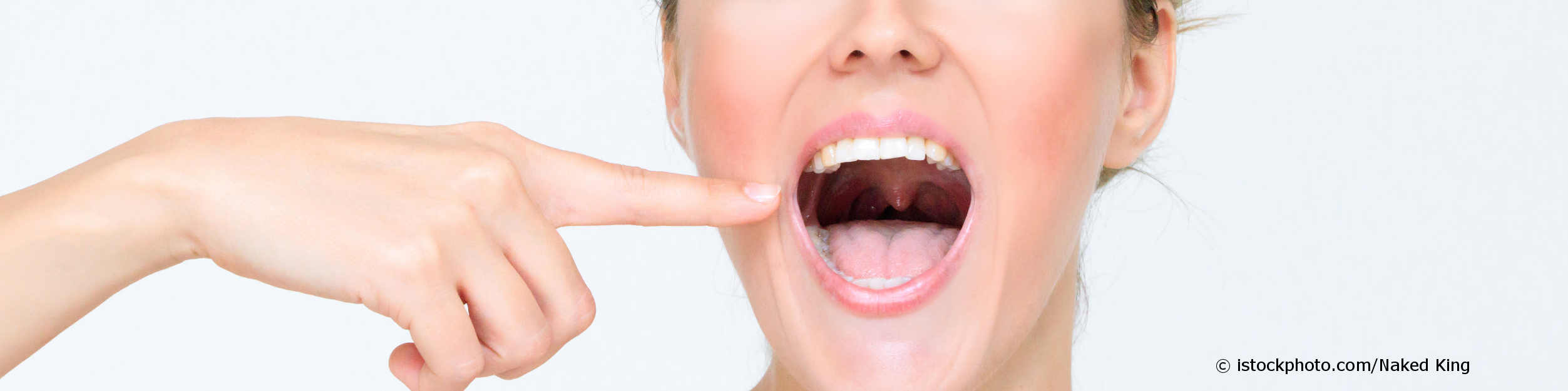 Junge Frau mit Mundgeruch zeigt auf ihre belegte Zunge und Rachen.